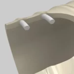 Indvendig struktur af NORPLAST® PUR 385 AIRFLEX AS med PVC-spiral og glat inderflade.